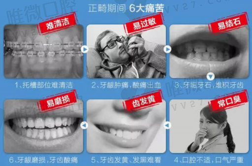 假牙贵和便宜区别在哪儿,假牙越贵的越好吗(图1)